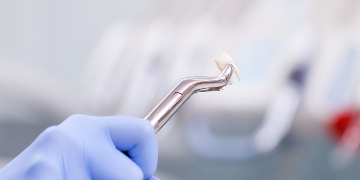 Beylikdüzü Diş Çekimi Beylikdüzü Diş Çekimi hakkında