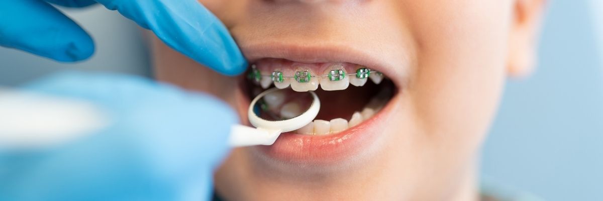 Beylikdüzü Çocuk Diş Hekimi ve kliniği